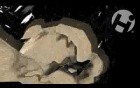 Volumated Feet Fractures