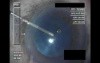 Swollen Conjunctiva - Part 1