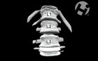 Volumated Ribs, Spine, and Clavicle