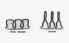Small Intestine - Celiac Sprue