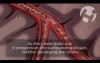 Neurologic Injury