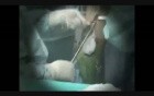 ACL Reconstruction using Hamstrings reinforced with specific LARS Ligament