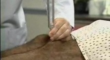 Sensory Assessment Vibration Sensation And Position
