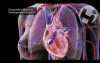 Pulmonary Emboli