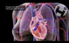 Pulmonary Emboli