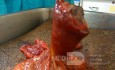 Ascending Colon Intussusception due to a Adenocarcinoma (1 of 6)