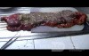 Endoscopic Image of Adenocarcinoma of the Transverse Colon (7 of 9)