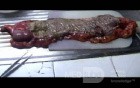 Endoscopic Image of Adenocarcinoma of the Transverse Colon (7 of 9)