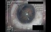 Cataract Surgery VI - Part 1