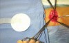Umbilical hernia repair video