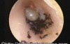 Ectoparasite in The Ear Canal