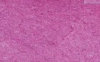 Secretory endometrium