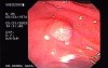 Rectum (23 of 30)
