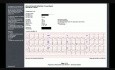 ECG Case 1