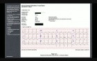 ECG Case 1