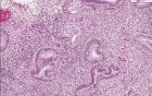 Placenta - Implantation site