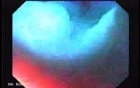 Gastric Folds - Magnification (4 of 8)