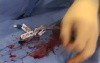 A Quick Way of Inserting a Warming or Cooling Catheter 