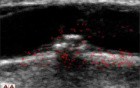 Motion Analysis of the CCA 