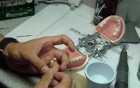 Anterior Bridge Preparation, Part 8 - Jet Provisional - Relining And Repairing Fracture