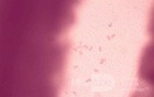 Colonoscopy observing a trichuris in the cecum (6 of 8)