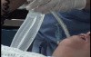 IGB Extraction - Intubation