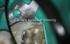 Periodontal - Endodontic considerations and dilemmas