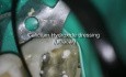 Periodontal - Endodontic considerations and dilemmas