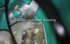Periodontal - Endodontic considerations and dilemmas