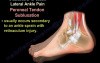 Ankle Pain - Ligaments, Sprain - Video Lecture