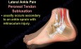 Ankle Pain - Ligaments, Sprain - Video Lecture