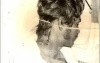 Arrow Injury Of The Neck