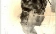 Arrow Injury Of The Neck
