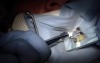 PDL Injection with a Short 30 gauge needle