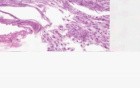 Nerve - Histology