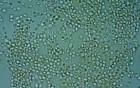 Microbiological Testing Of Feces - Candida