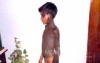 Hyperpigmentation Of The Skin - Other Shot (2)