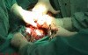 How to Perform Cesarean Section - Opening, Part 1