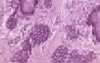 Tongue Foliate Papilla - Histology