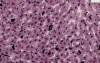 Liver Kupffer Cells - Histology