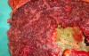 Multiple Rectal Ulcers (86 of 110)