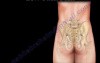 Sacroiliac Joint - Low Back Pain Cause - Video Lecture