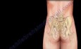 Sacroiliac Joint - Low Back Pain Cause - Video Lecture