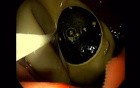 Endoscopic Balloon Removal (3 of 9)