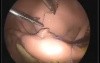 EVE ETX- laparoscopic surgeries simulator