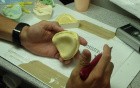 Occlusal Rim Fabrication - Keep The Denture Base Thin