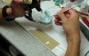 Dental Implants - Poor Implant Position