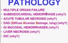 Hemodynamic Disorders, Thromboembolic Disease and Shock - MSP - 4k