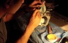 Diagnostic Waxup Part 4