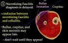 Necrotizing Fasciitis - Video Lecture - Part 2